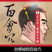 治便秘的百会穴