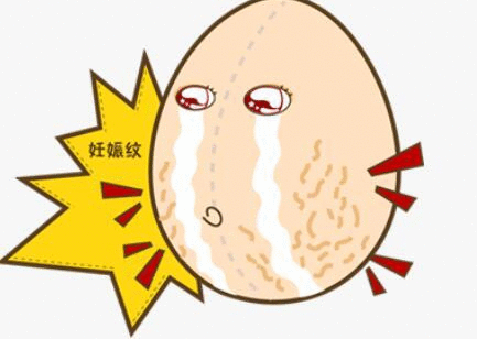 北京焕星医疗美容激光去妊娠纹 结果成这样