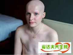 乳腺癌骨转移还能活多久?