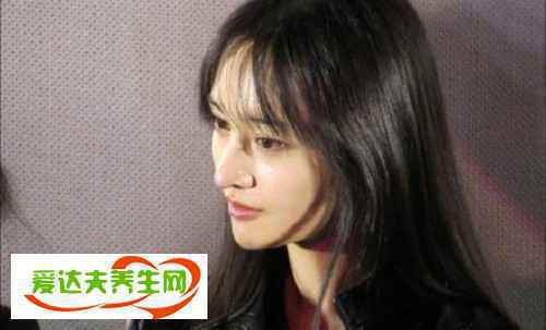 郑爽整了哪里
