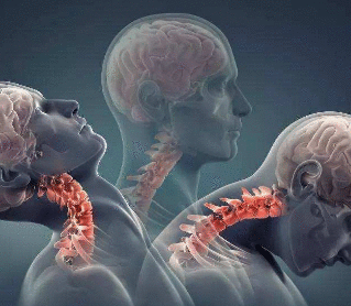 偏头痛影响睡眠