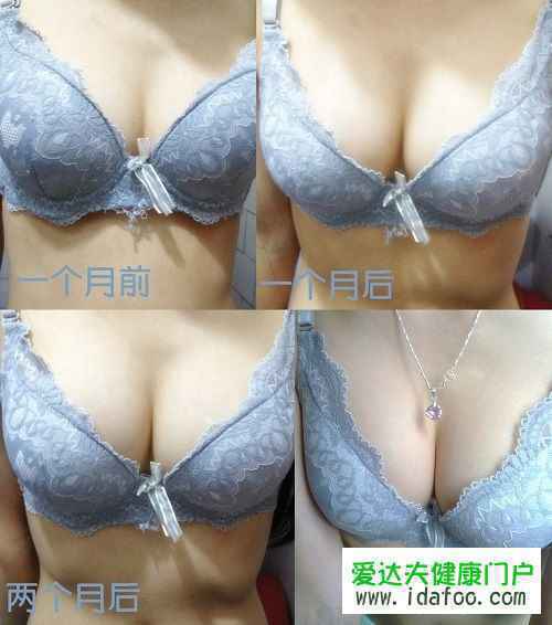 哺乳后如何恢复胸