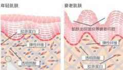 爱贝芙除皱的植入材料安全吗