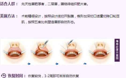 厚唇改薄手术有后遗症吗