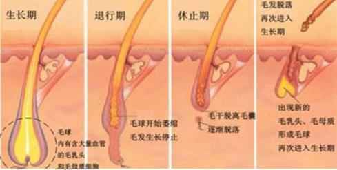 激光比基尼脱毛安全可靠吗