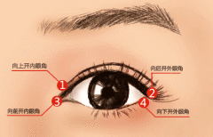 开内眼角术后应该怎样护理