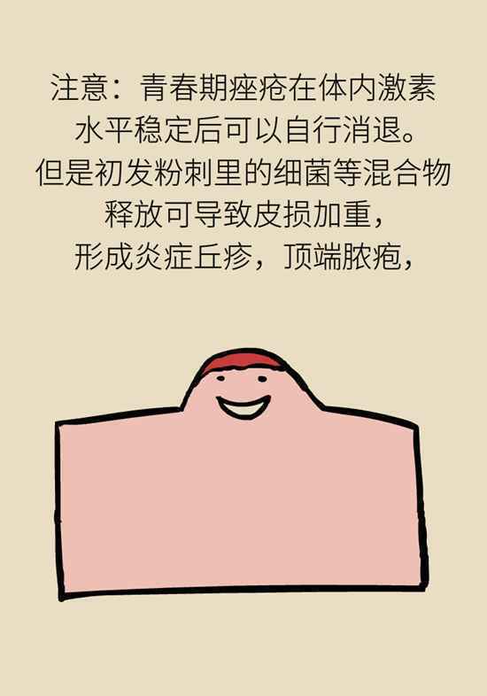 男孩挤痘进ICU？别再用生命战“痘”了