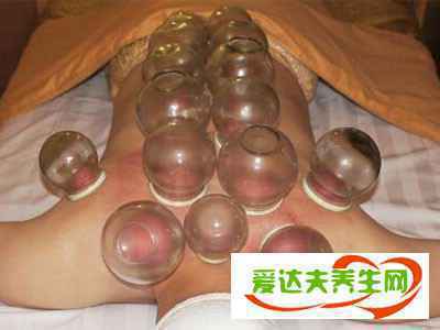 拔罐瘦身