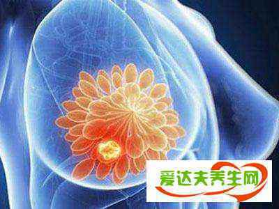 乳房刺痛