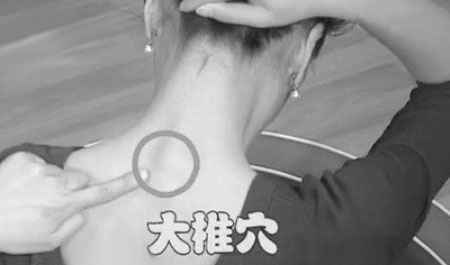 热伤风怎么办 中医特色疗法治夏季热伤风