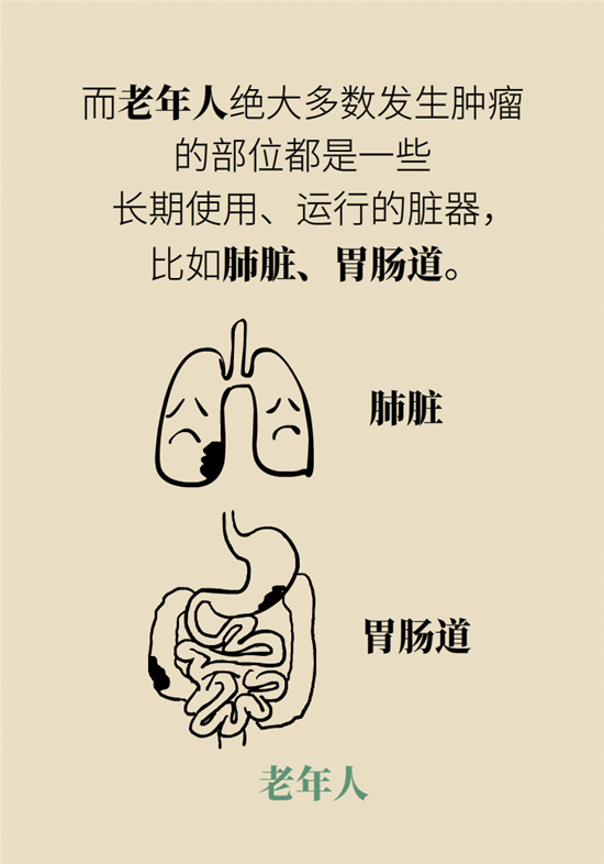 肿瘤筛查有必要做吗？首先你得学会选择