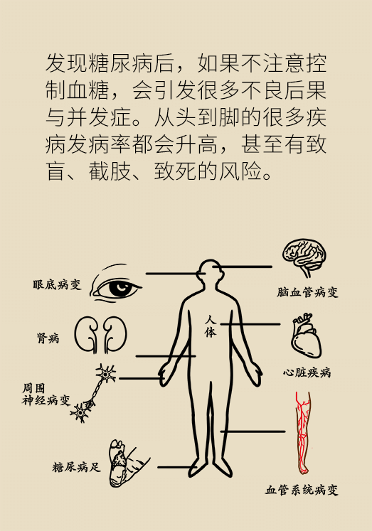 糖尿病是因为吃糖或主食太多？协和内分泌科主