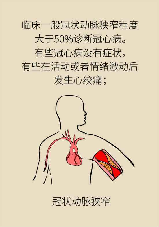 情绪一激动胸口就发闷？你可能患上了慢性冠状