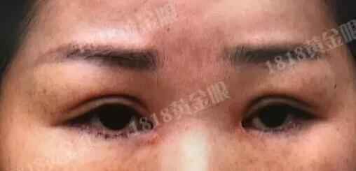 杭州女子做完整形后上班遭拒 老板娘：太吓人了