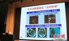 北京首个“体医融合”实验室成立 探索非医疗健