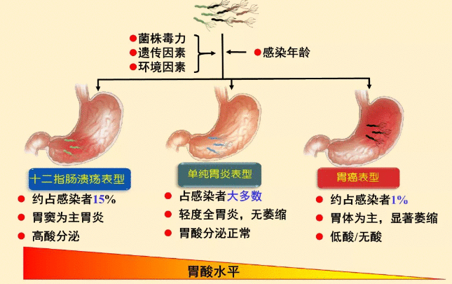 放任幽门螺杆菌不管,会有什么严重后果?