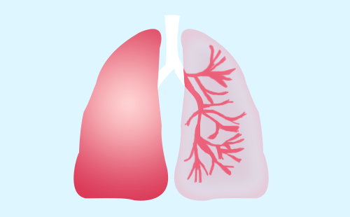 肺癌肺部器官身体健康癌症